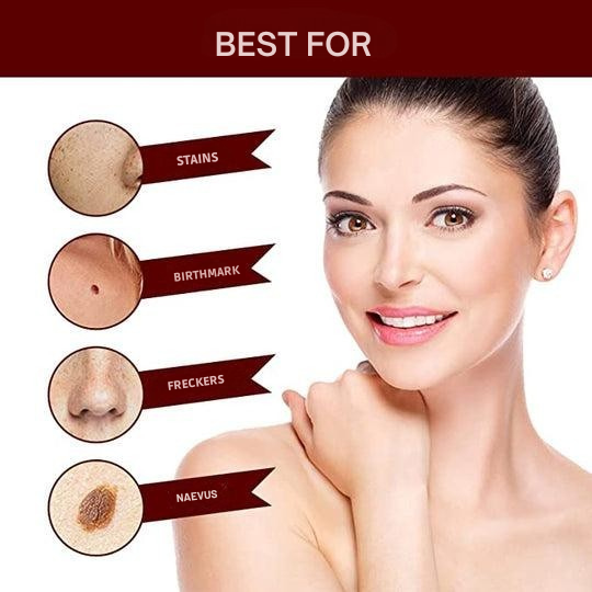 Precision Skin Tag & Wart Removal Pen with Botanical Extract Formula for At-Home Spot Treatment
