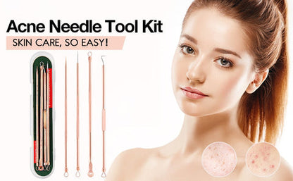 Essential Blackhead & Pimple Extractor Kit with Protective Case for Flawless Skin
