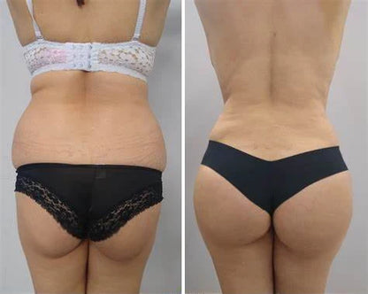 Butt Enhancement Cream Firming & Lifting Shea Butter