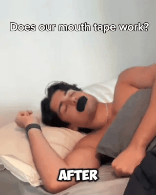 Mouth Tape Gentle Cotton Adhesive 30 Pack