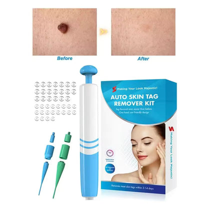Wart Remover Liquid for Warts and Moles, Non Invasive At Home Wart Removal for All Skin Types, 50 ml