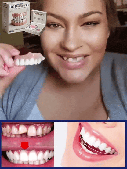 Moldable Cosmetic Dental Veneers Upper & Lower Set Reusable Snap-On Smile Kit for Instant Confidence Natural Look Temp Teeth Cover