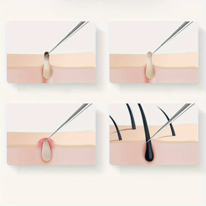 ClearSkin Pro - Stainless Steel Blackhead and Whitehead Remover