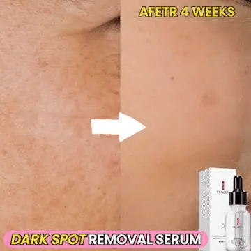 Sérum correcteur de taches brunes à action rapide d'origine végétale