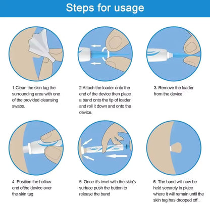 DermaLinx | Wart Remover for Pain-Free Skin Treatment | Effective Solution for Smooth Skin