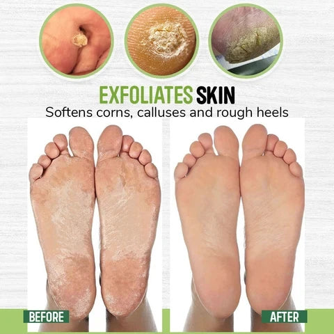 Foot Soak Tablets Herbal Anti-Fungal & Antibacterial