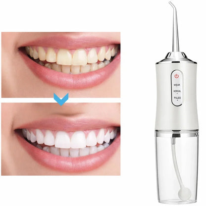 Cordless Water Flosser with 3 Pressure Modes for Travel & Home – Rechargeable Dental Irrigator for Braces, Gums & Deep Cleaning