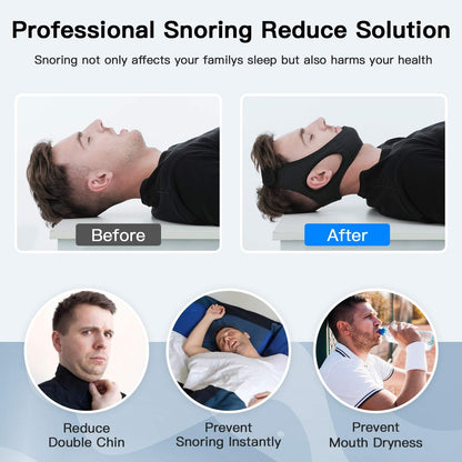 Sangle de maintien pour la respiration buccale – Mentonnière réglable pour un confort nocturne et un meilleur repos