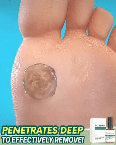 Corn & Wart Removal Gel Fast-Acting Brush Applicator