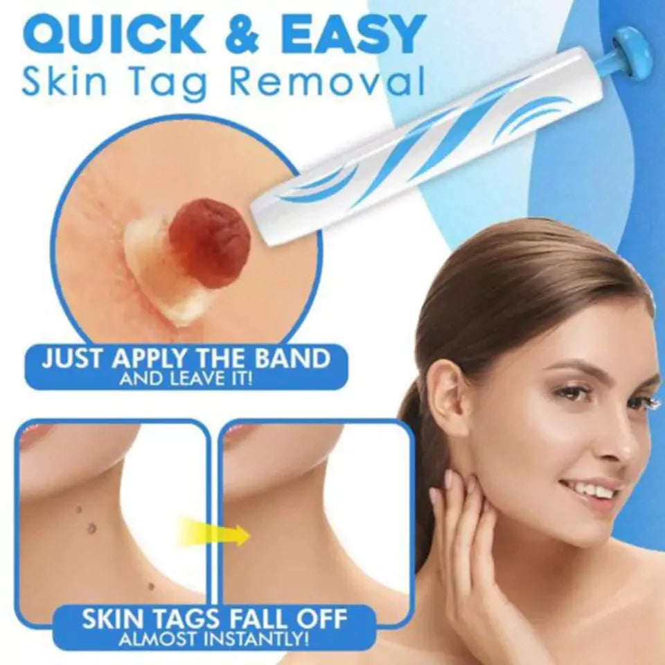 Aero Tag Remover Kit | Pain-Free Skin Tag Solution