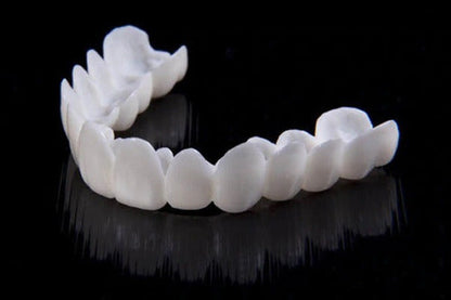 Removable Smile Veneers – Temporary Cosmetic Teeth Covers for Gaps, Stains & Chips – Custom-Mold Upper Arch for Confident Speaking & Eating
