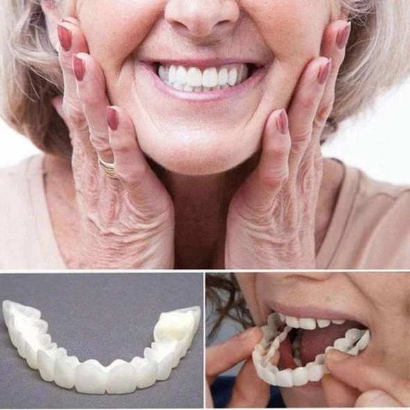 Kit de facettes dentaires naturelles pour les dents du haut et du bas