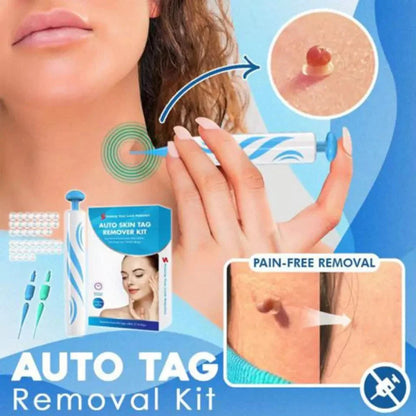 Aero Tag Remover Kit | Pain-Free Skin Tag Solution