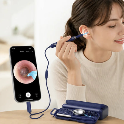 Caméra de nettoyage d'oreilles avec vision en direct, flexible et facile à transporter