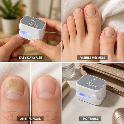 Traitement contre les mycoses des ongles : sérum antifongique quotidien de 7 minutes