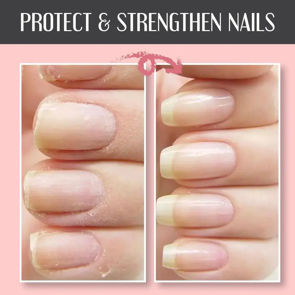 Nail Repair Gel for Cracked & Damaged Nails – No UV Light Required – Clear Protective Coating for Natural Nails