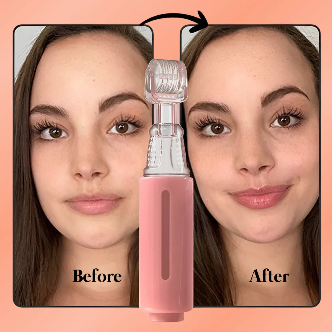 Natural Lip Plumper Kit | Gentle Formula for Fuller Lips | Boost Confidence with Easy Use