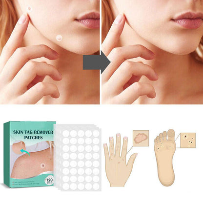 Hydrocolloid Skin Tag & Wart Remover Patches 120-Pack | Gentle Spot Treatment for Home Use | Invisible Adhesive Discs with Tea Tree Oil for