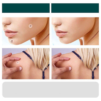 Hydrocolloid Skin Tag & Wart Remover Patches 120-Pack | Gentle Spot Treatment for Home Use | Invisible Adhesive Discs with Tea Tree Oil for