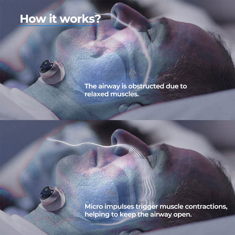 Anti Snore Chin Clip Device | Soft Adjustable Sleep Aid with Ergonomic Design | Comfortable Nighttime Chin Support