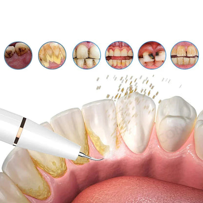 Nettoyeur dentaire à ultrasons, détartreur avec éliminateur de plaque, appareil rechargeable pour enlever les taches sur les dents à domicile