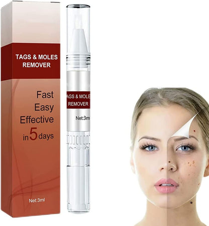 Skin Tag & Wart Removal Pen with Precision Applicator Tip for Spot Treatment at Home | Natural Plant-Based Formula