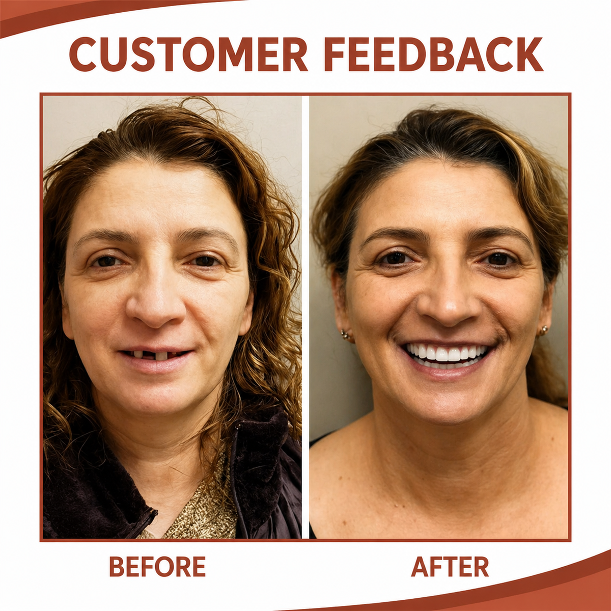 Denture Cushion Pads | Soft Silicone Liners for Upper & Lower Dentures | Custom-Fit Grip Comfort Kit
