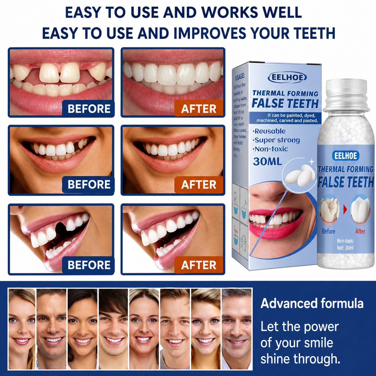 Temporary Tooth Repair Kit for Chipped Gaps Missing Teeth at Home Moldable Resin Filler Natural White Cosmetic Dental Fix Adults Kids Senior