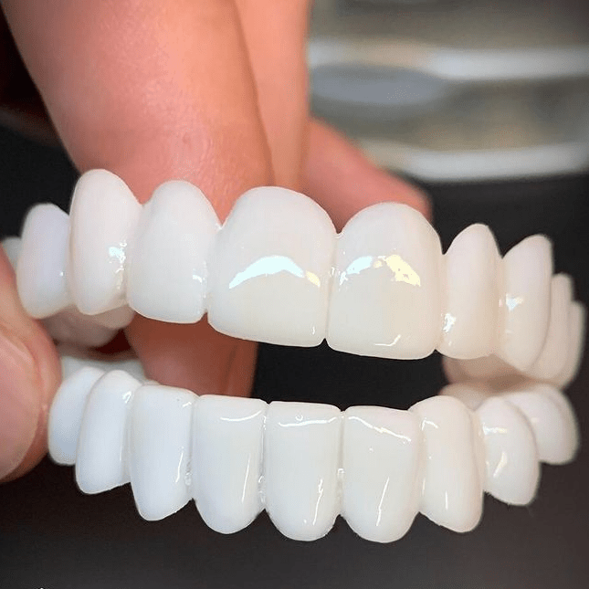 Temporary Cosmetic Dental Veneers for Instant Smile Enhancement – Reusable Snap-On Teeth Cover for Photos, Events & Daily Confidence Boost