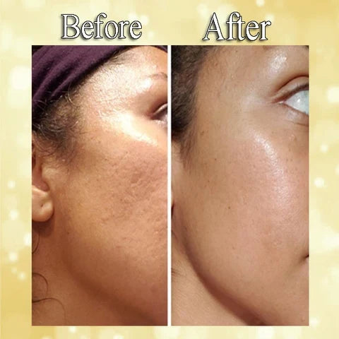 Sérum anti-âge à l'or 24K et à l'acide hyaluronique