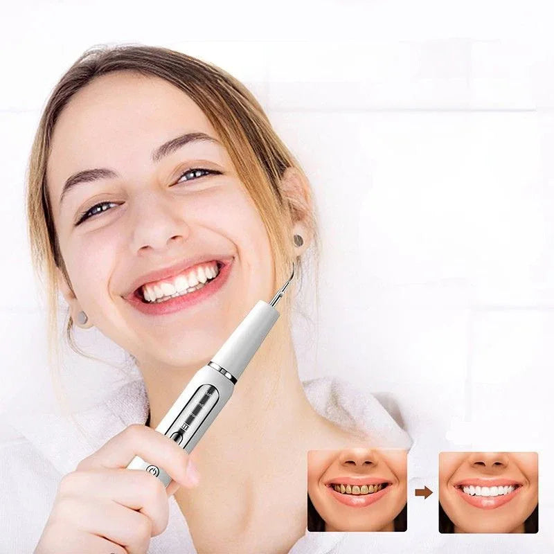 Ultrasonic Tooth Cleaner USB Rechargeable for Home Dental Care with LED Light & 3 Power Modes | Tartar Plaque Remover Kit with Stainless