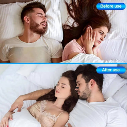 Bandes nasales confortables pour faciliter la respiration nocturne