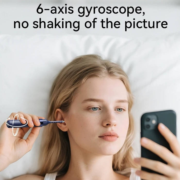 Otoscope sans fil avec vidéo HD et étui de transport