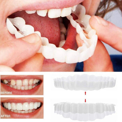 Facettes dentaires Easy Fit Clip On pour dents supérieures et inférieures
