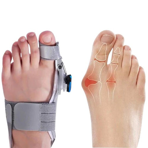 Correcteur d'écartement d'orteils réglable pour l'alignement du pied