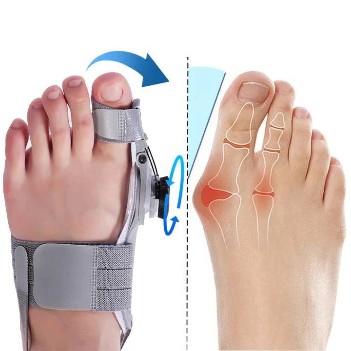 Correcteur d'écartement d'orteils réglable pour l'alignement du pied