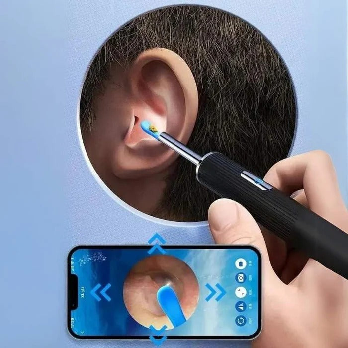 Endoscope auriculaire sans fil avec caméra lumineuse LED