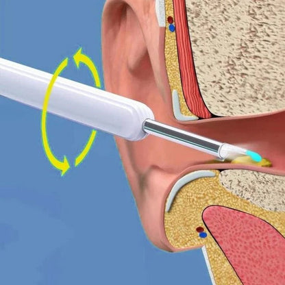 Endoscope auriculaire sans fil avec caméra lumineuse LED