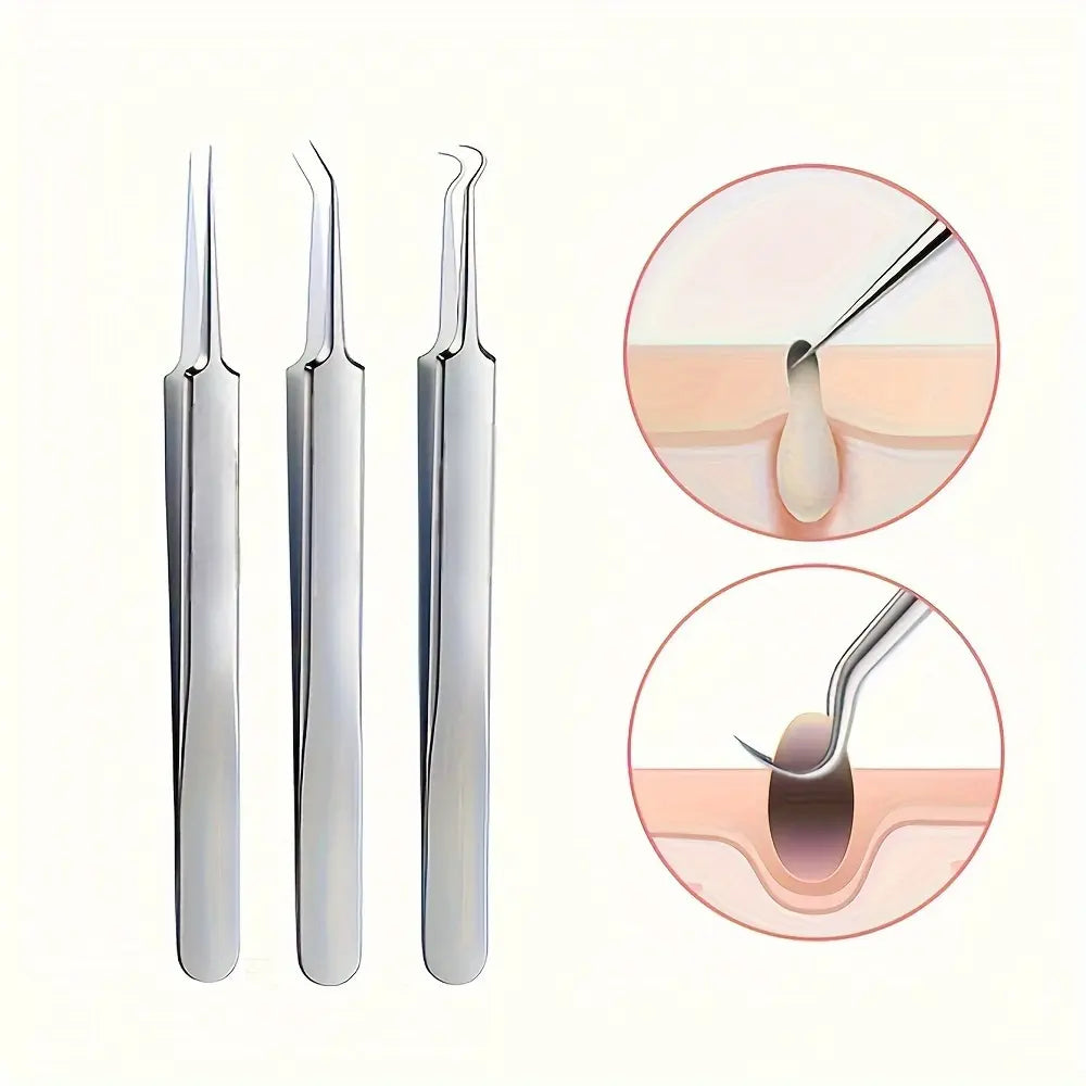 Stainless Steel Pore Extractor Tools for Acne, Clogged Pores, and Blemish Care at Home – Professional Skincare Set