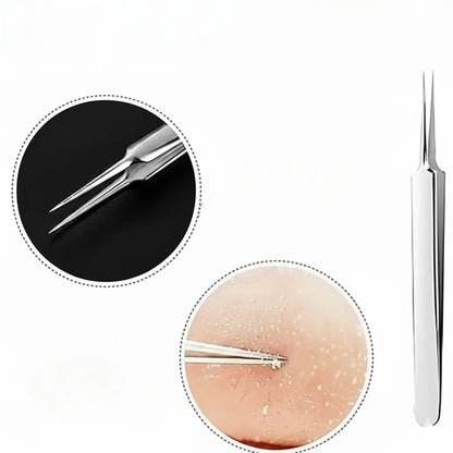 Stainless Steel Pore Extractor Tools for Acne, Clogged Pores, and Blemish Care at Home – Professional Skincare Set