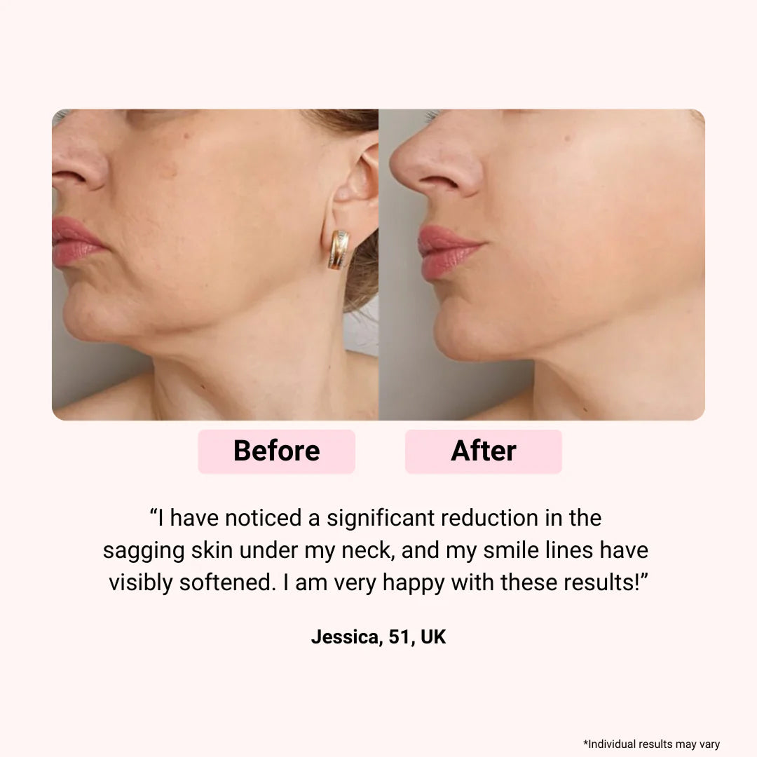 LED Light Therapy Face Mask for Anti-Aging, Acne & Skin Rejuvenation – Professional Multi-Color Photon Treatment System with Remote