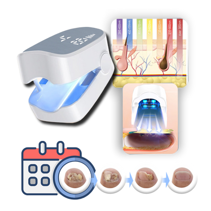 Appareil de luminothérapie rechargeable pour le soin des ongles, double mode LED bleue et traitement au laser froid, utilisation quotidienne portable de 7 minutes pour les ongles d'orteils et