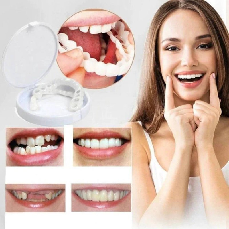 Kit de facettes dentaires facile pour un sourire parfait