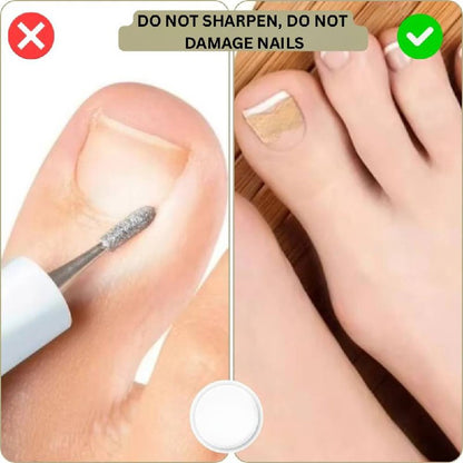 Solution rapide pour les ongles cassés et incarnés