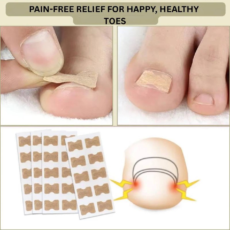 Solution rapide pour les ongles cassés et incarnés