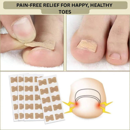 Solution rapide pour les ongles cassés et incarnés