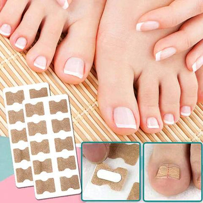 Solution rapide pour les ongles cassés et incarnés