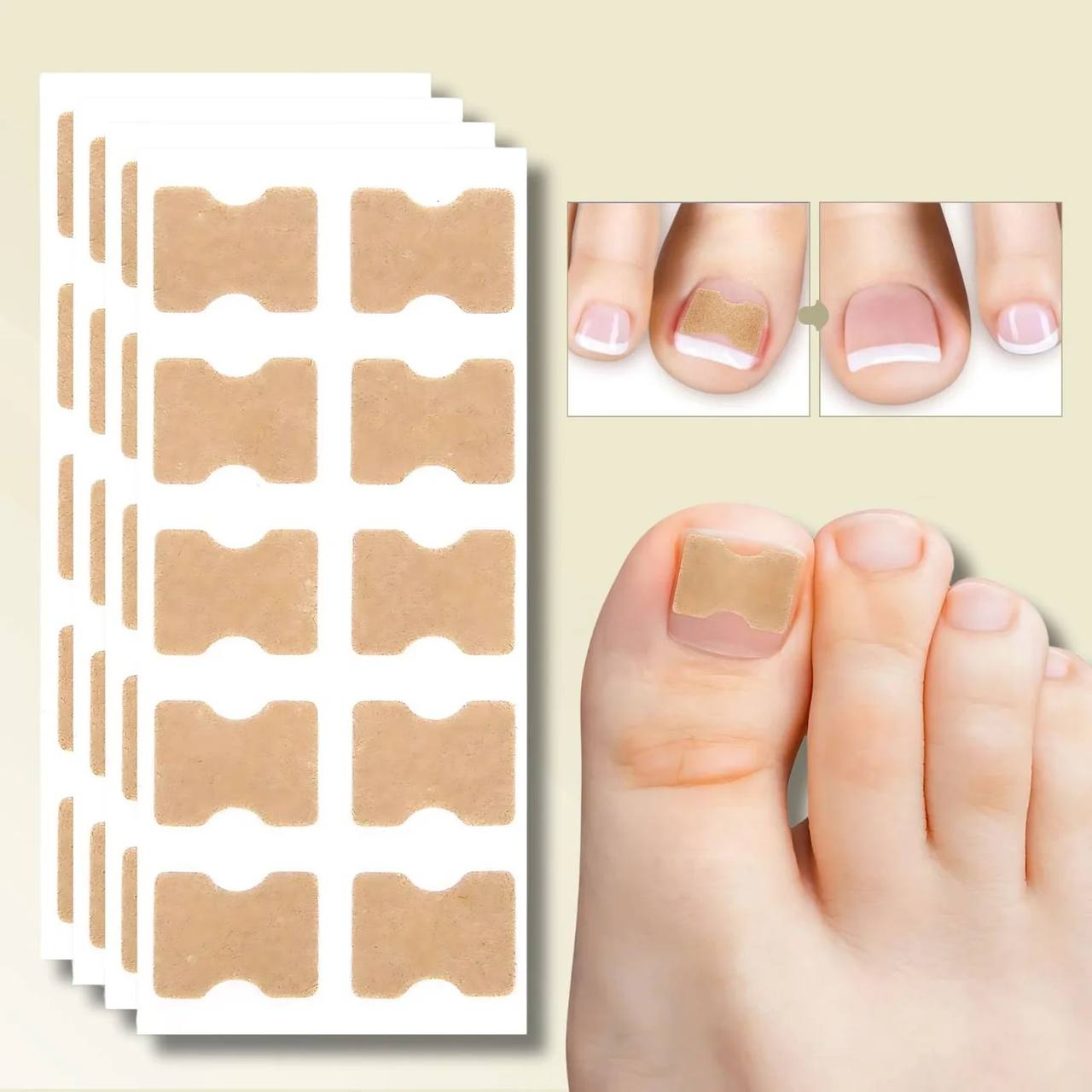 Fast Nail Fix for Broken and Ingrown Nails - Ortekor