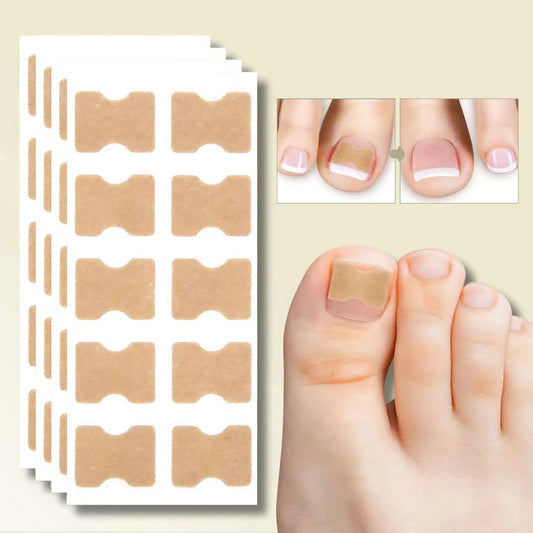 Fast Nail Fix for Broken and Ingrown Nails - Ortekor