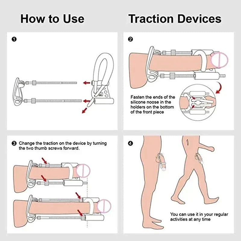 Medical-Grade Penile Extender for Natural Enhancement | Adjustable Traction System for Lasting Results